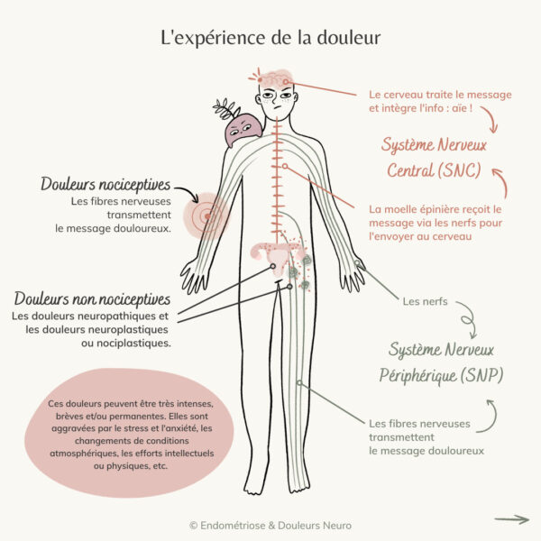 Douleurs neuropathiques & nociceptives Association Endométriose & Douleurs Neuro